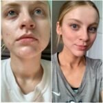 Gelmicin Cream Safety: Science-Backed Use Guide